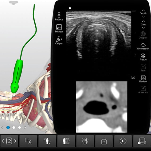 upper_airway_case_screen__36729 upper_airway_case_screen__36729