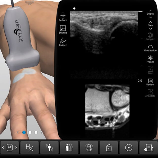 wrist_case_screen__80487 wrist_case_screen__80487
