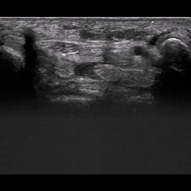 wrist_ultrasound__67150