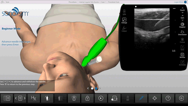 Needle-based procedures are relevant for POCUS learners and can be practiced in the SonoSimulator