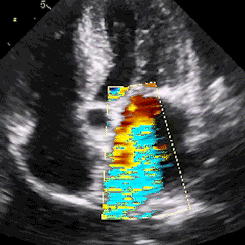 Scan cardiac ultrasound