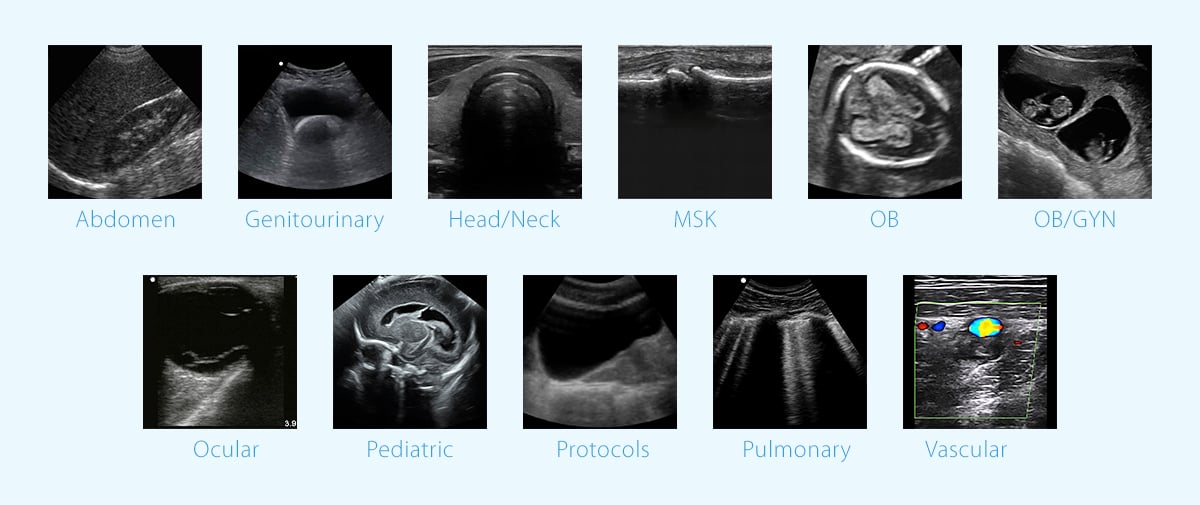 Various ultrasound specialties for academic programs shown through various ultrasound images