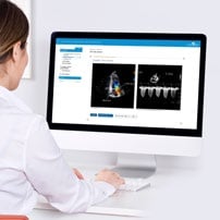 Learner taking a SonoSim ultrasound course, part of the SonoSim learn element