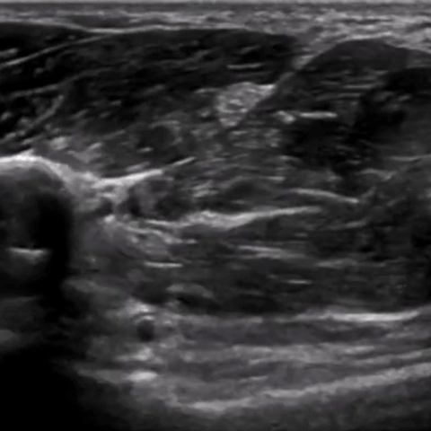 How to learn ultrasound for MSK
