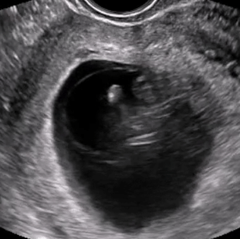 Practice OB/GYN ultrasound scanning
