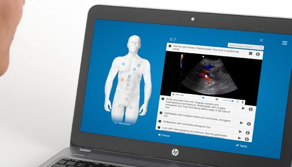 Patient pathology is customizable in this ultrasound simulator which can make no two cases the same