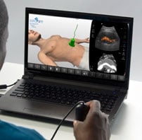 Learning ultrasound scanning with SonoSim gives learners access to thousands of real-patient cases