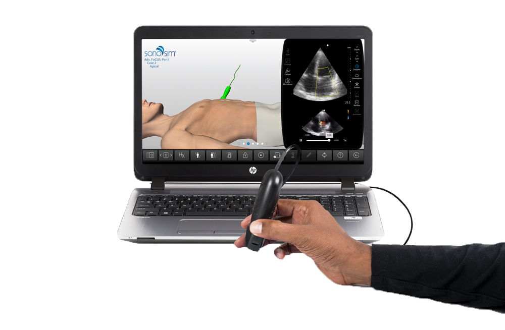 SonoSimulator_72424.2 SonoSimulator_72424.2