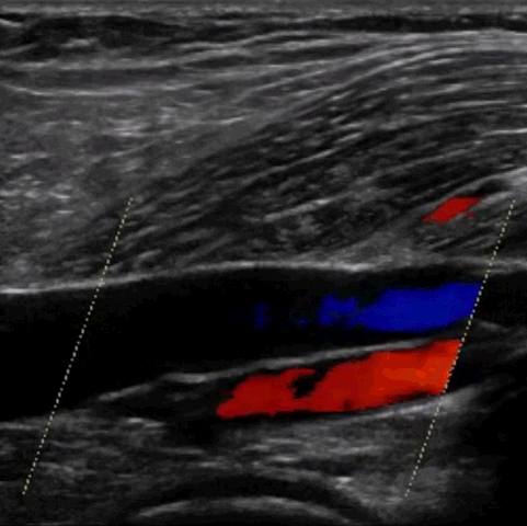 Learning ultrasound scanning for vascular imaging