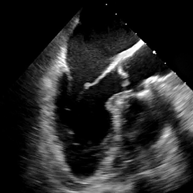 adv_tee_ultrasound__95621