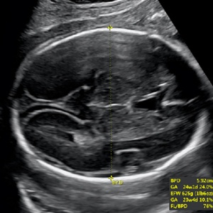 Basic Obstetric – Six-Step Approach