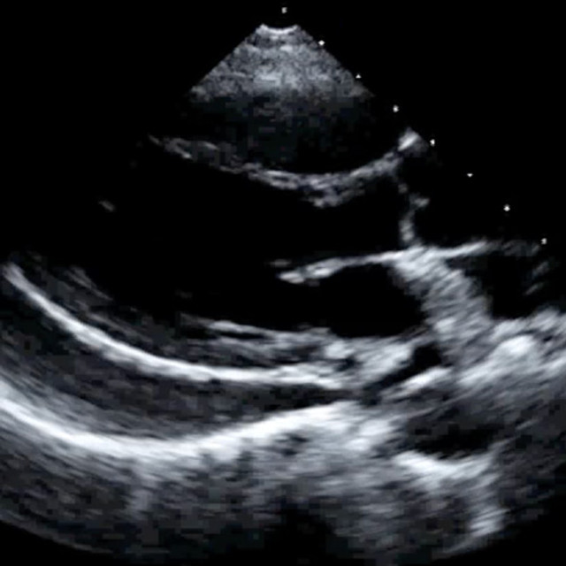 Clinical cardiology ultrasound training scan