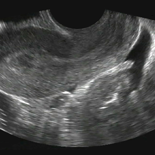 OB/GYN