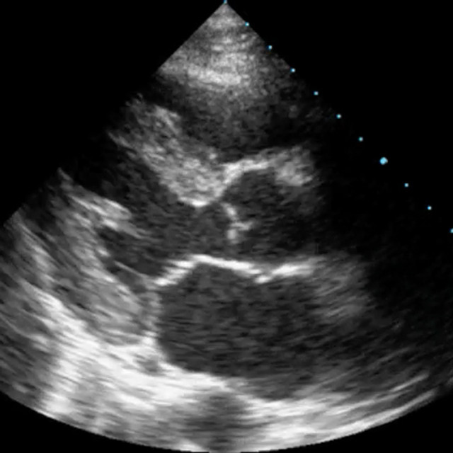 Clinical RUSH protocol ultrasound image for point of care ultrasound training