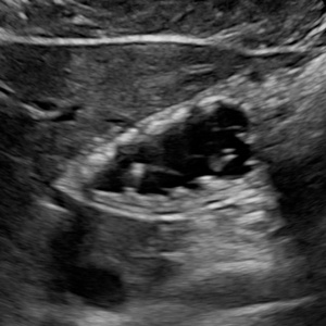 gastric gastric