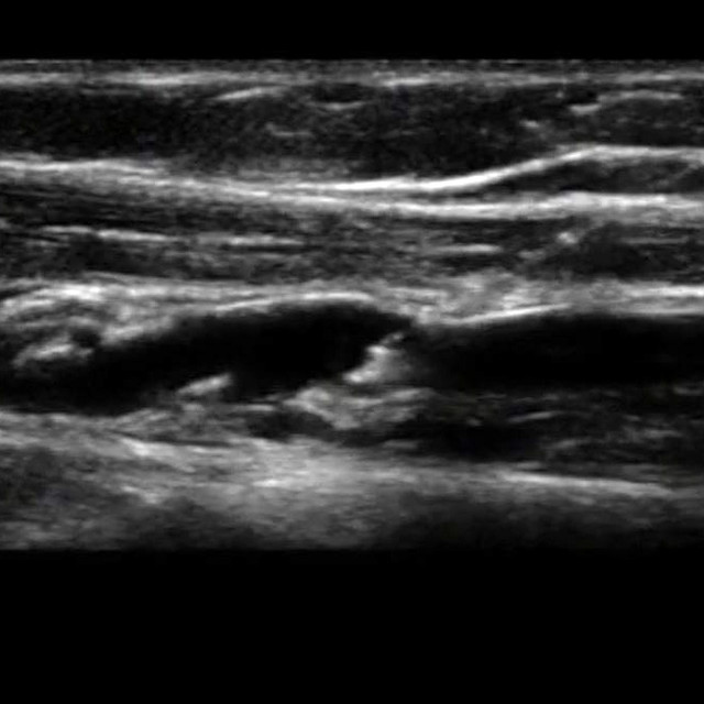 Peripheral ultrasound image for point of care ultrasound training applications