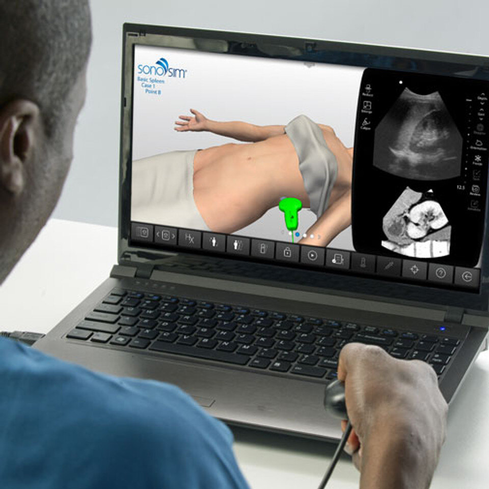 Spleen Anatomy & Physiology Ultrasound Training | SonoSim